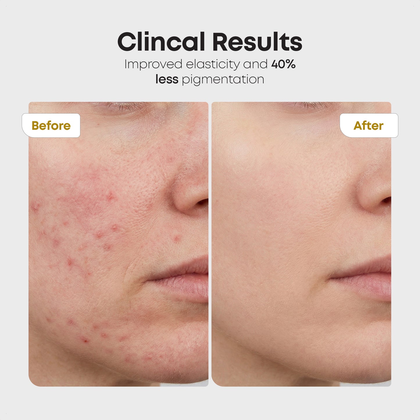 Red light & Near infrared therapy LED face mask