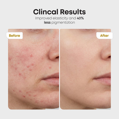 Red light & Near infrared therapy LED face mask