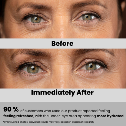 Collagen & Gold Hydrogel Eye Pads