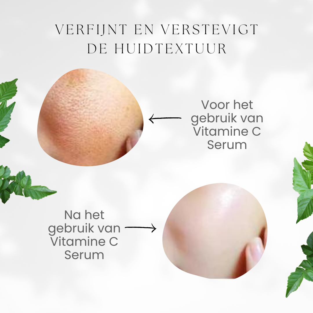 Vitamin C Serum: Energie en Stralende Huid